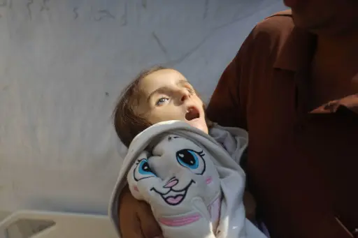 One harrowing UNRWA image shows a frail 4-year-old Gazan girl “lost her life due to malnutrition and lack of treatment due to the war on Gaza”